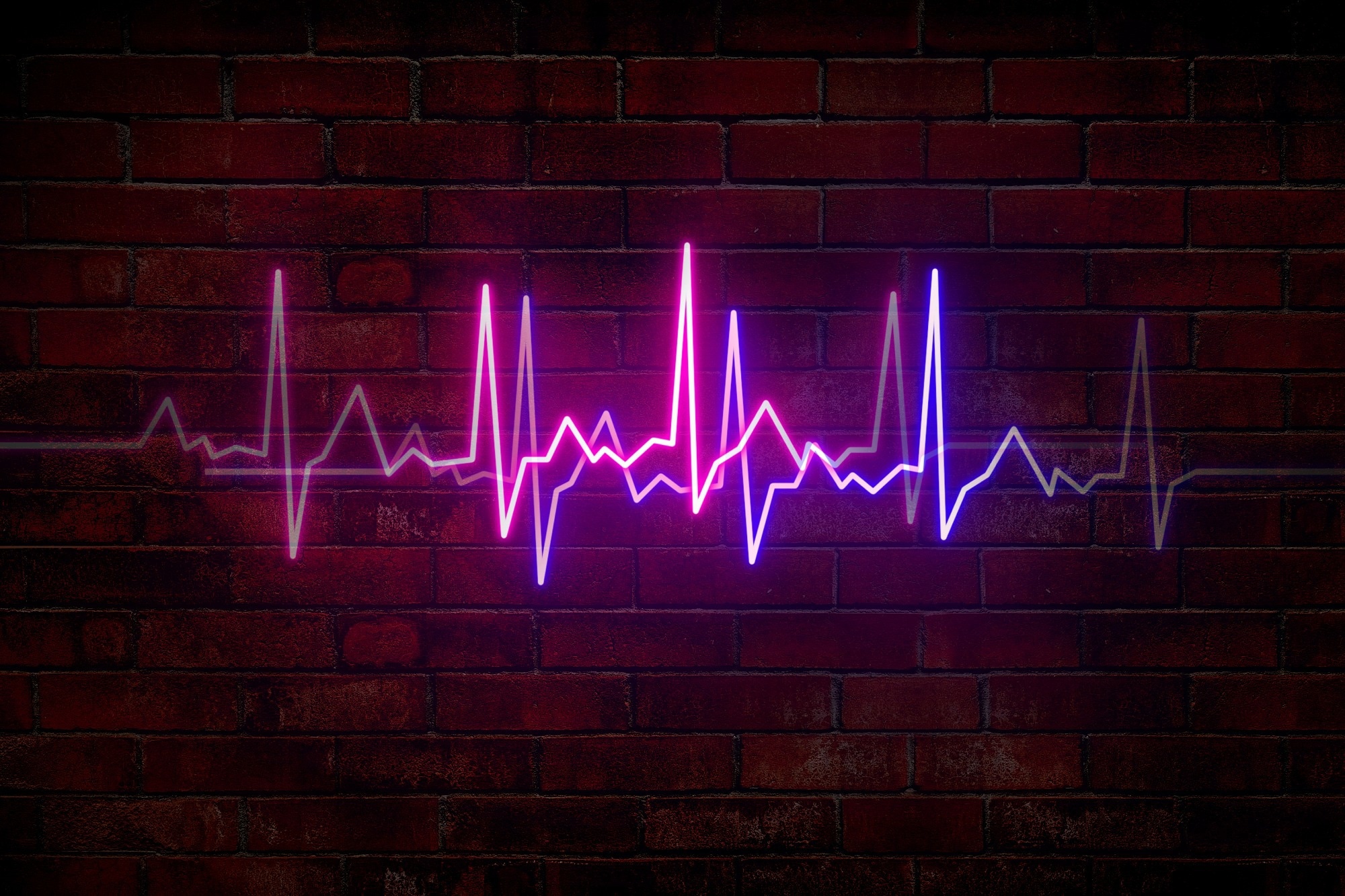 Does COVID-19 affect heart rate variability after recovery?