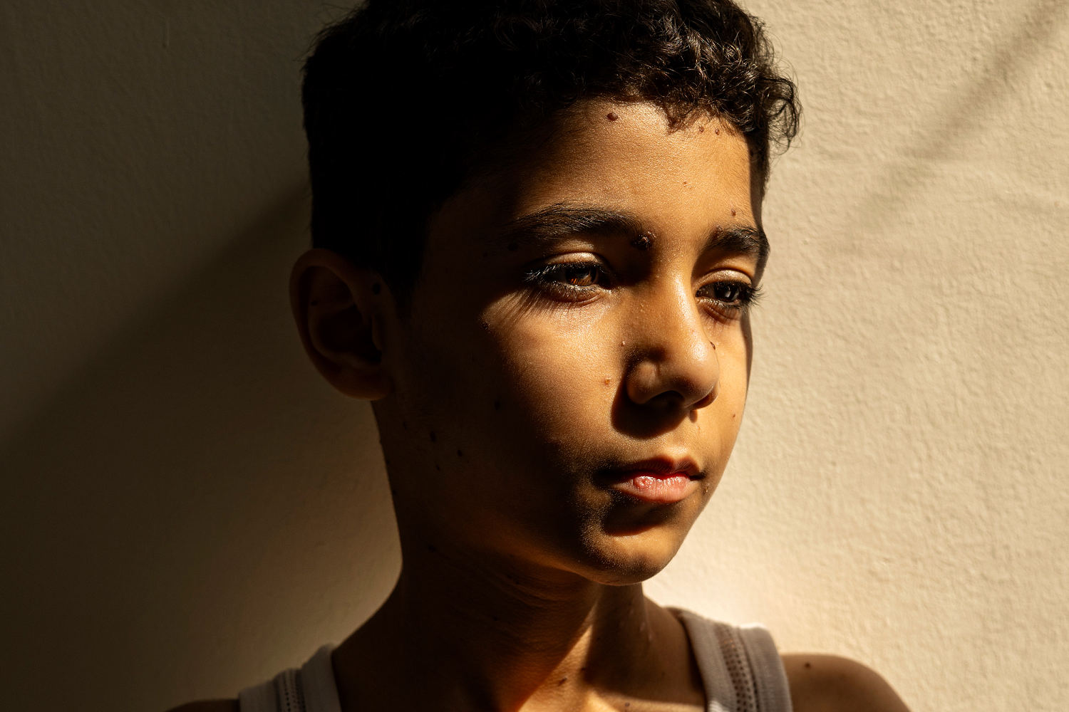 Portrait of Palestinian boy who lost both arms in Israeli strike named press photo of the year