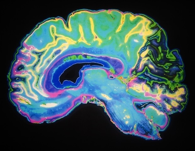 Study offers insight into how the brain handles multiple pieces of information