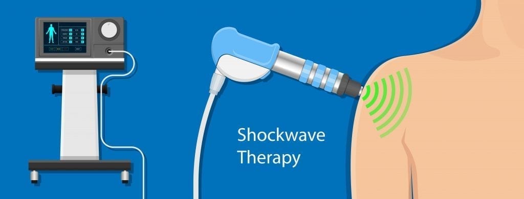 Making Waves or Just Noise? A Look at Shockwave Therapy