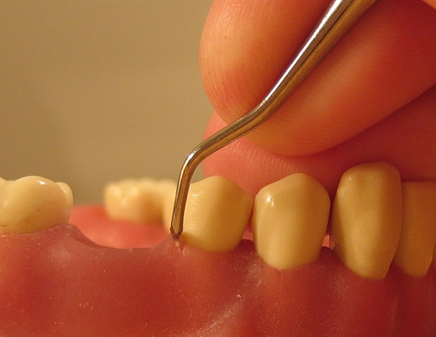 Anti-inflammatory drug can prevent and alleviate periodontal tissue damage