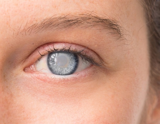 NR2F1 promotes cataract formation by activating STAT3 pathway