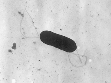 What to know about food poisoning illnesses caused by listeria