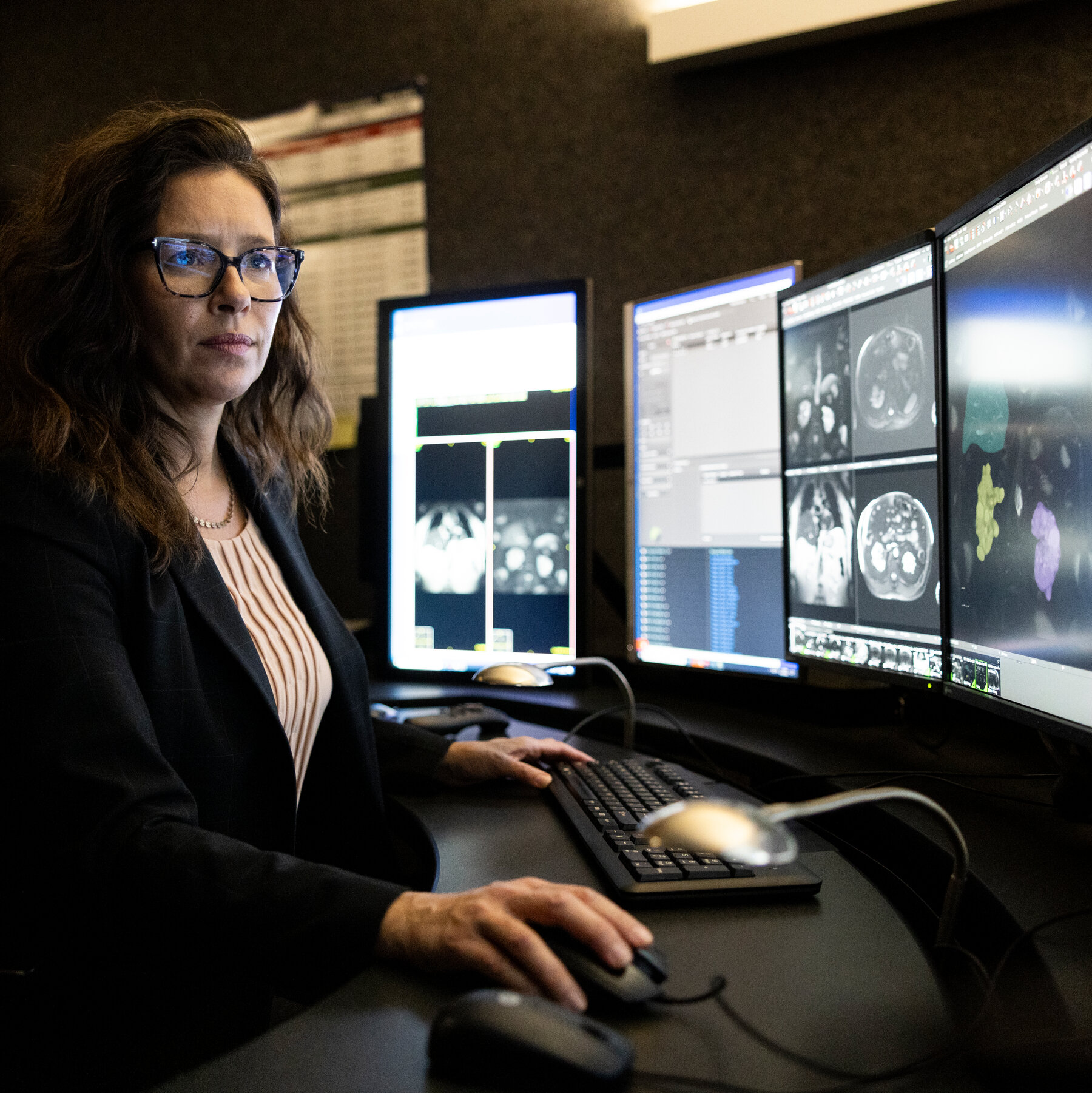 A.I. Was Coming for Radiologists’ Jobs. So Far, They’re Just More Efficient.