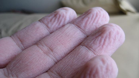Fingers always wrinkle in the same way