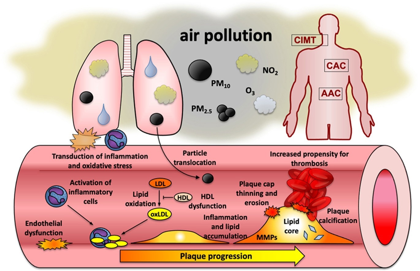 Air pollution fuels artery damage and accelerates heart disease, review finds