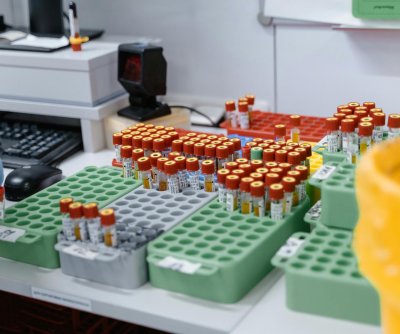 New blood test screens for thousands of rare inherited diseases at once