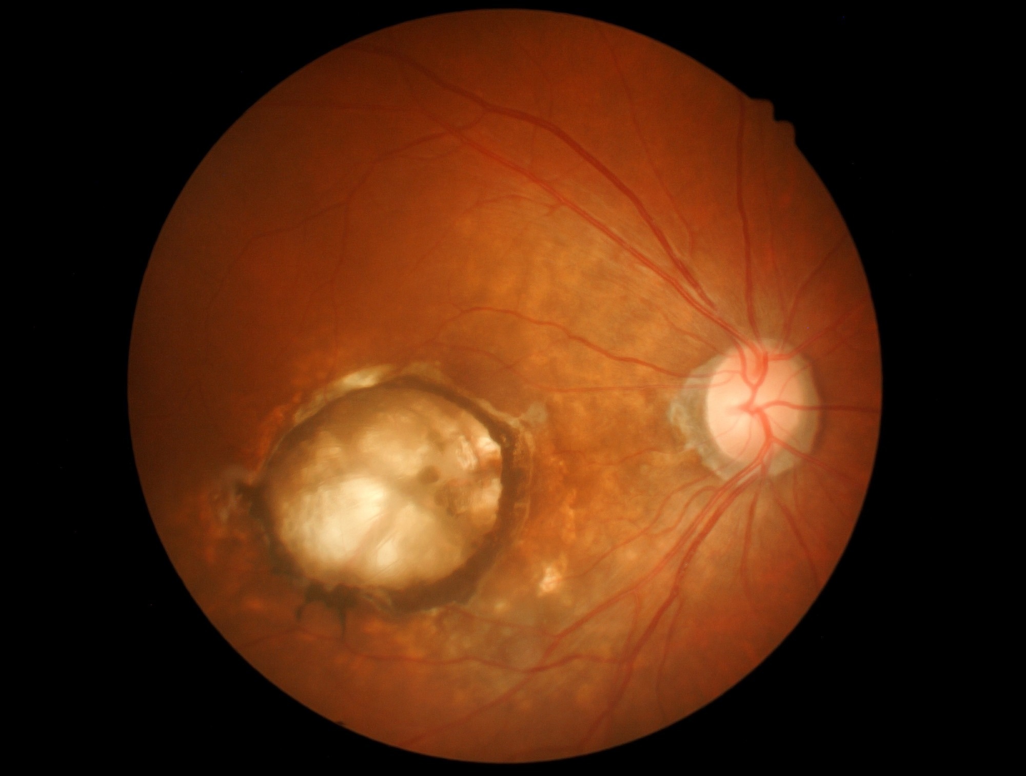 Oral 8-aminoguanine protects aging eyes and preserves vision in preclinical study