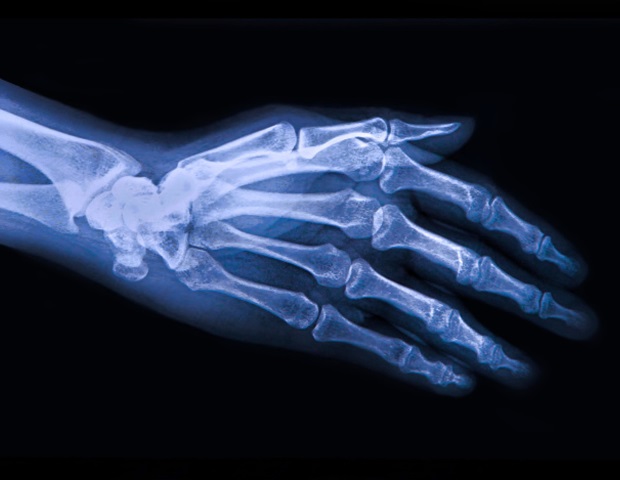 New VR system transforms hand rehabilitation with load free design