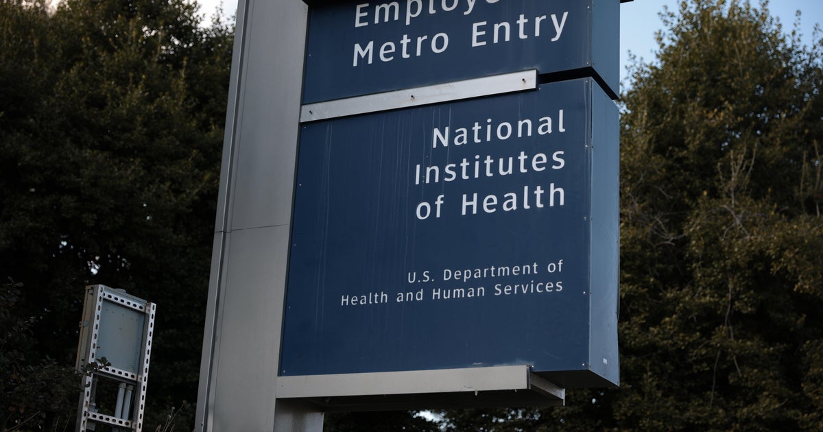 Trump administration ending multiple HIV vaccine studies