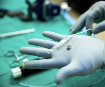 Paradromics implants brain-computer interface into first human patient