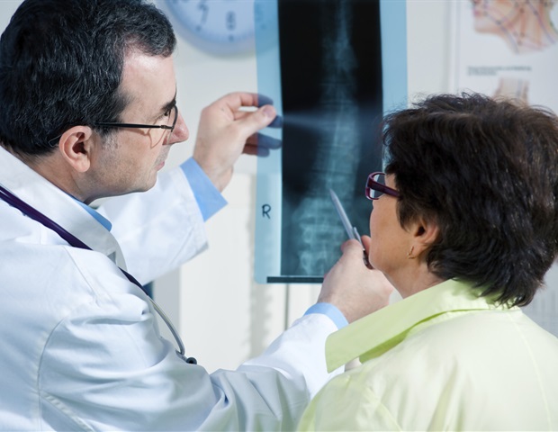 Generative AI system from Northwestern doubles radiology efficiency