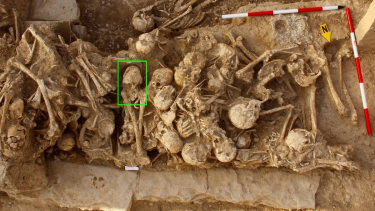 ‘Cone-headed’ skull from Iran was bashed in 6,200 years ago, but no one knows why