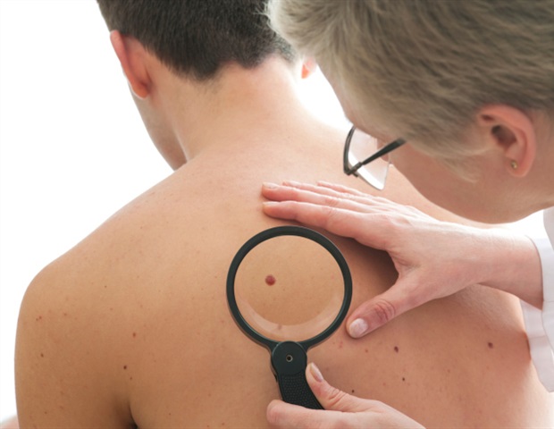 Breakthrough tumor profiling study offers hope for more precise skin cancer care