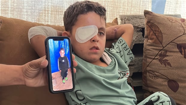 This Palestinian boy lost his eye to an unexploded bomb. Thousands of tonnes of explosives may remain in Gaza