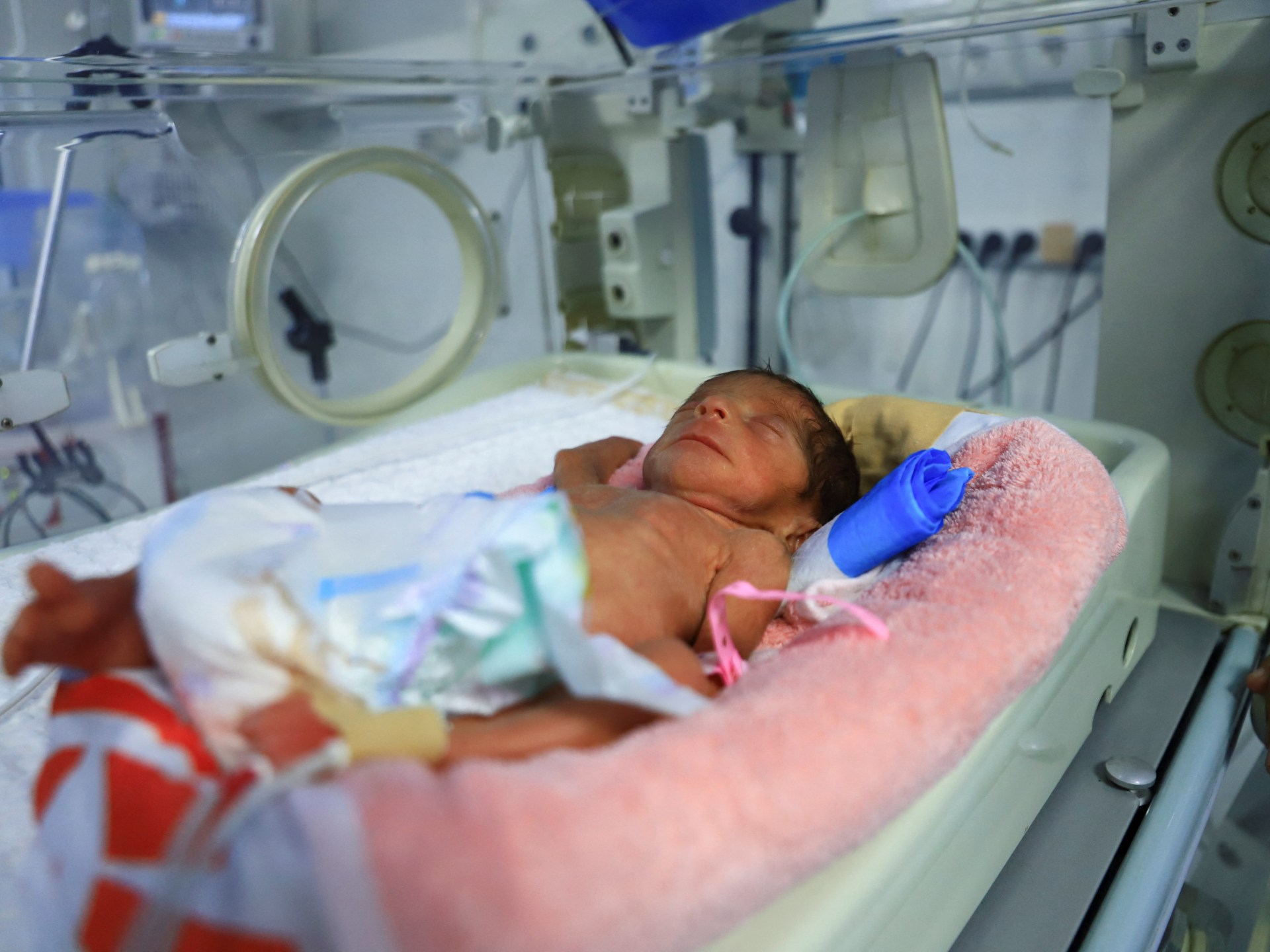 UN reports uptick in preventable diseases in Gaza due to Israeli blockade