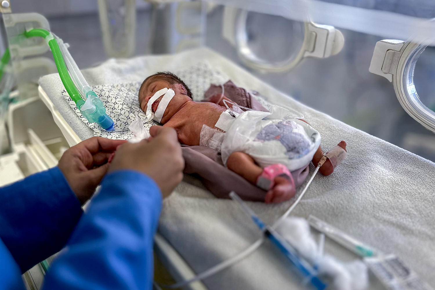 Without baby formula, some infants in Gaza are facing a slow death