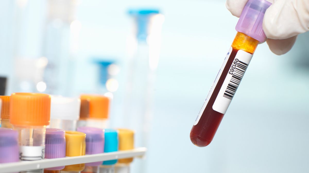 ‘She is the only person in the world compatible with herself’ — scientists discover new blood type but it’s unique to just one person from Guadeloupe