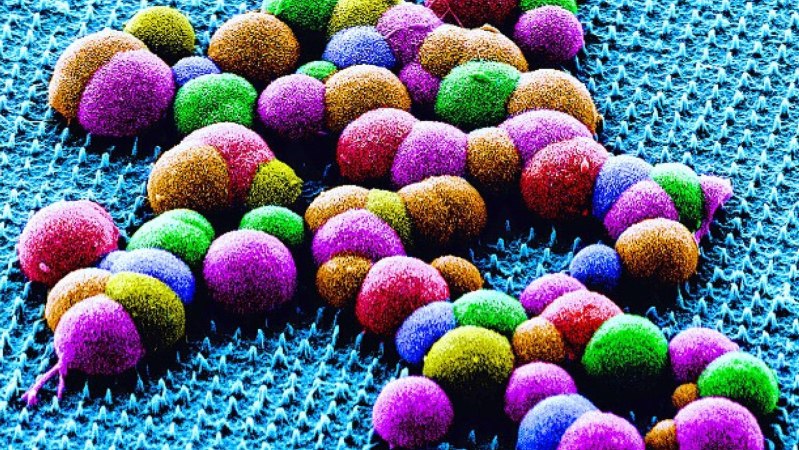 This painless nanoneedle patch might one day replace certain biopsies
