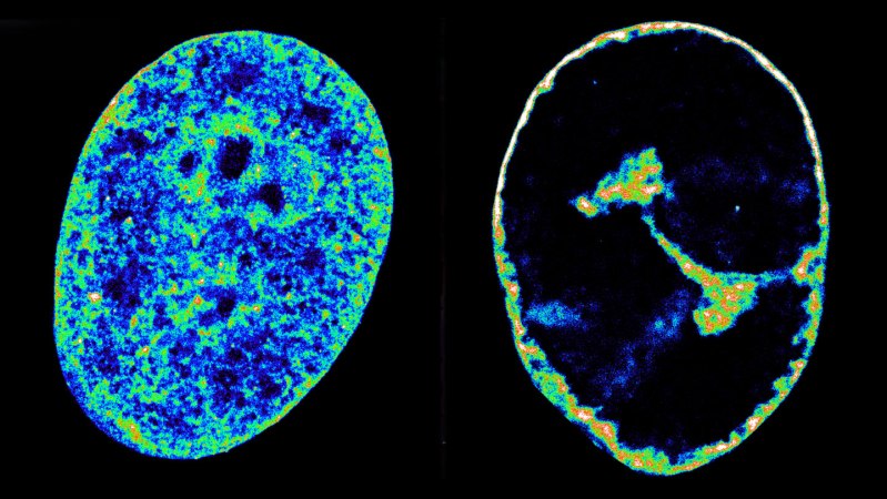 See how the herpesvirus reshapes our cells’ DNA in just eight hours