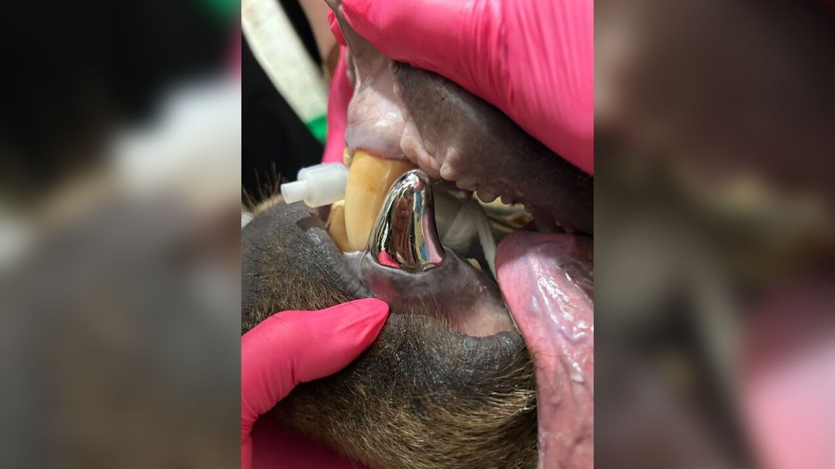 Bear’s new metal tooth is world’s biggest-ever crown