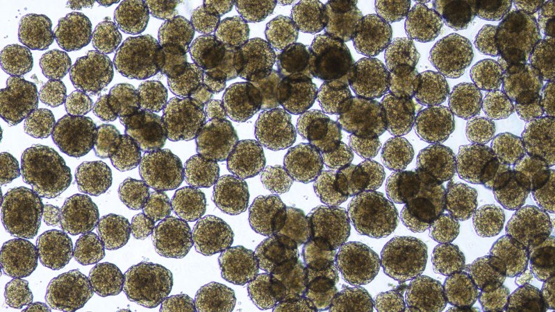 A new diabetes treatment could free people from insulin injections