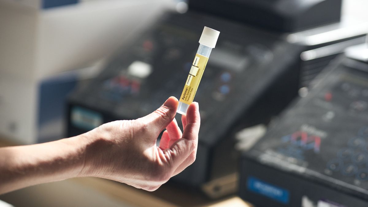 Scientists transform pee into material fit for medical implants