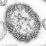 Measles no longer actively spreading in Gaines County, the epicenter of Texas’s outbreak