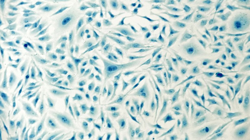 Scientists 3-D printed a tiny elephant inside a cell