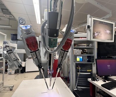 Robotic surgery hits ‘milestone’ with autonomous gallbladder removal