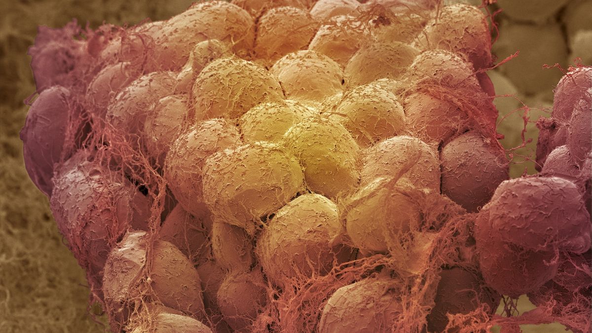 Weight loss may ‘rejuvenate’ fat tissues, clearing away aged cells