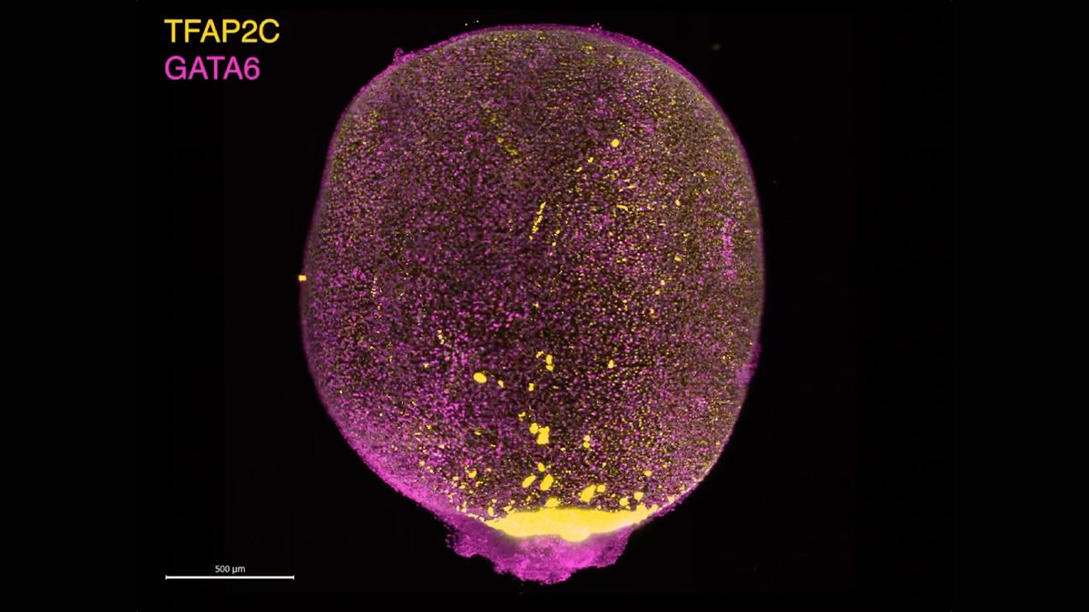 Scientists grow mini amniotic sacs in the lab using stem cells