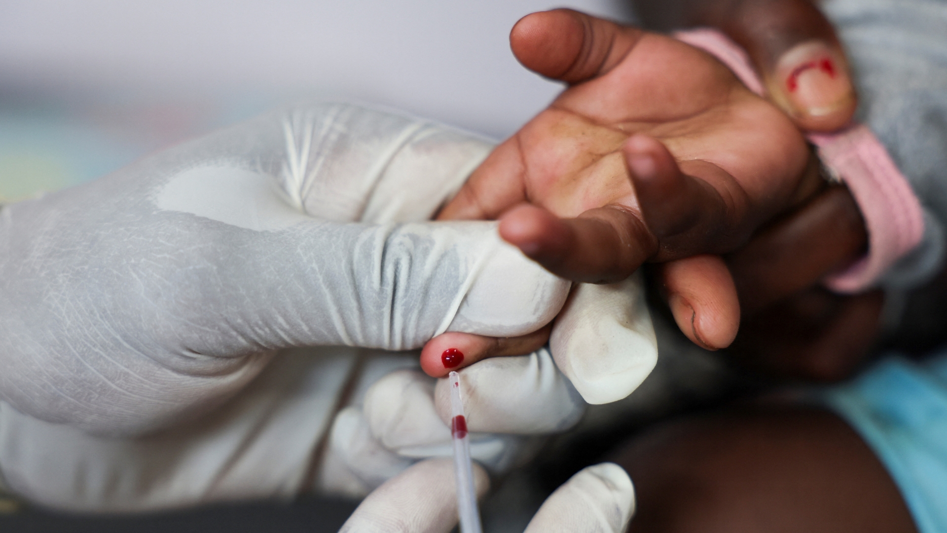 How can countries save the lives of people living with HIV?