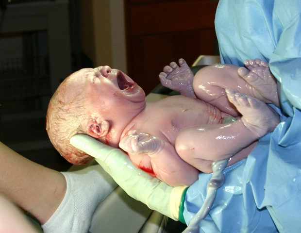 Early antibiotic exposure weakens infant immune development