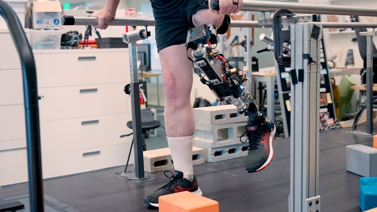 New bionic knee connects directly with muscles and bone to feel more like the user’s body