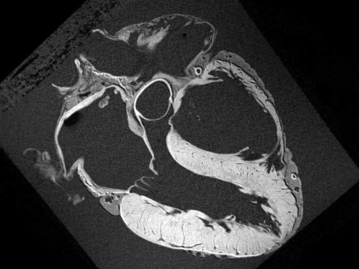 As Diseases Spread and Trust in the FDA Crumbles, Its Leaders Are Obsessed with an MRI Abnormality in 1 in 61,500 Males Ages 12-24