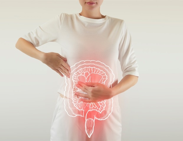 Combination of dysbiosis, OTUD3 gene mutations, and STING signaling linked to ulcerative colitis severity