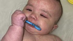 How Canada became the centre of a measles outbreak in North America
