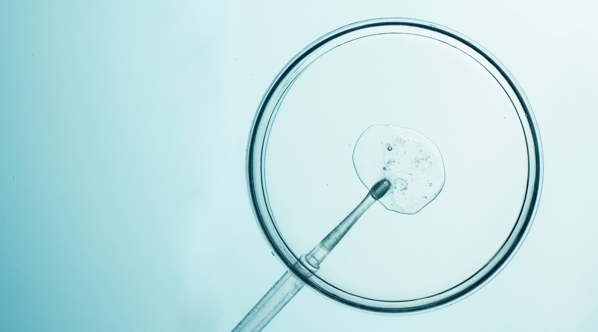 Sperm RNA profiles could identify the best embryos for IVF