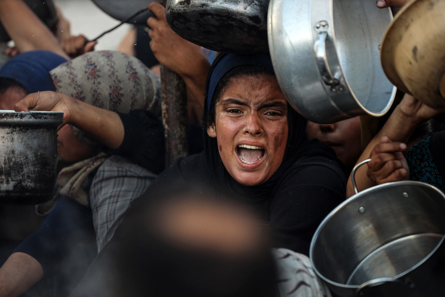 Gaza’s hunger crisis has killed hundreds — including dozens of children from malnutrition