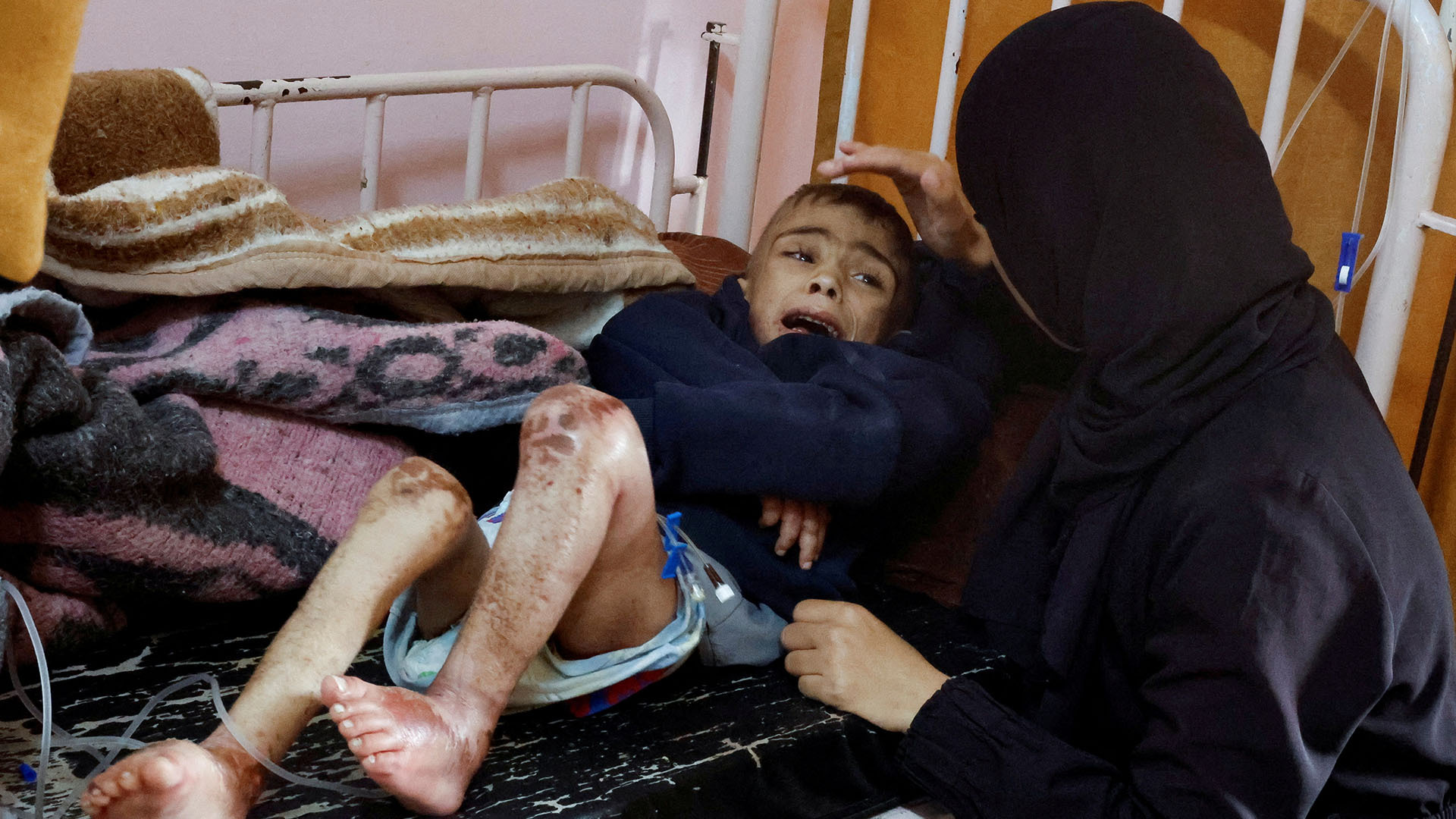 ‘Starvation is a war crime’, UN expert blasts Israel
