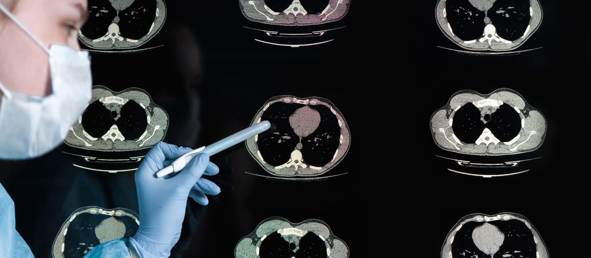 Study reveals pandemic life made brains age faster, even without catching COVID-19