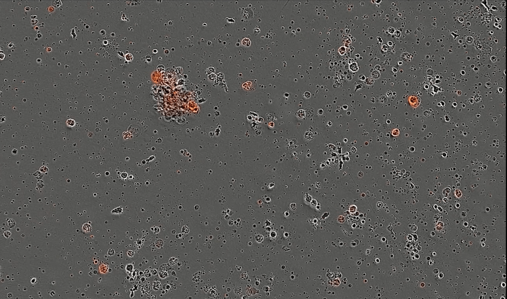 AI is designing proteins that could help treat cancer