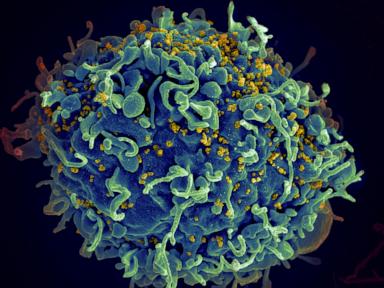 EU regulator green lights an injectable HIV drug that could help stop transmission
