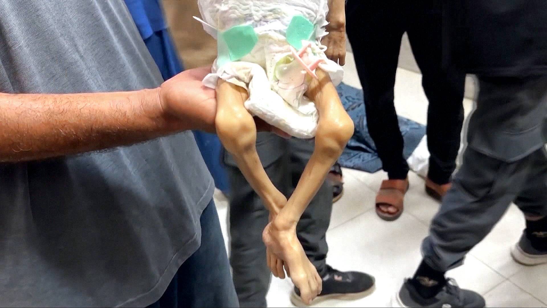 What has Israel’s denial of food done to Gaza’s people?