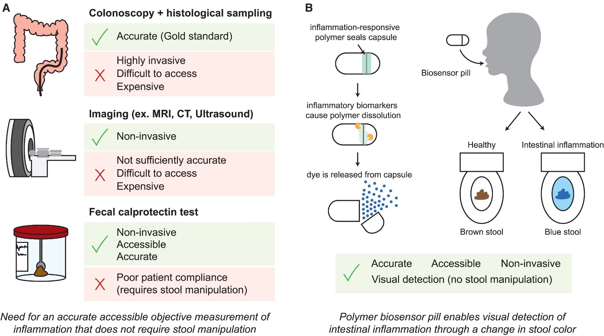 New swallowable sensor pill reveals gut inflammation with a simple color change
