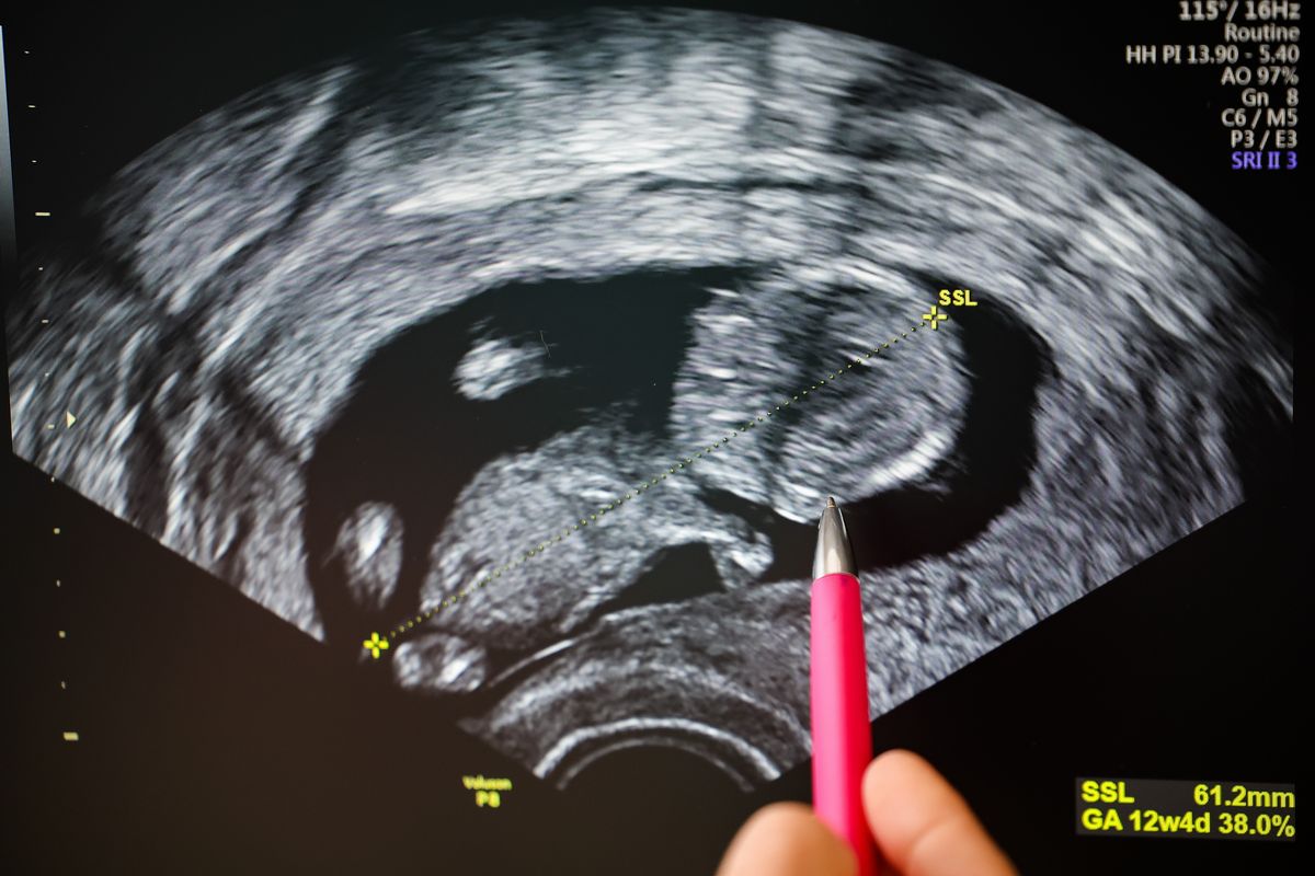 Unraveling claim Louisiana voted to force 9-year-old rape victim to carry pregnancy