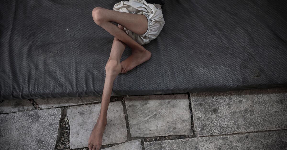 Israelis rebuff Trump, insisting images of starvation in Gaza are ‘fake’
