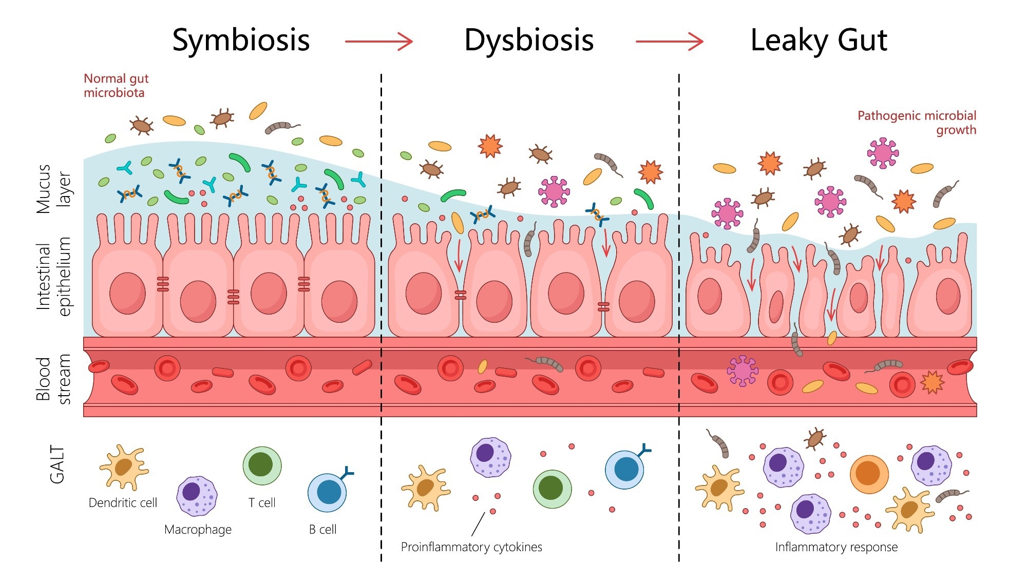 How a leaky gut could be putting your heart at risk