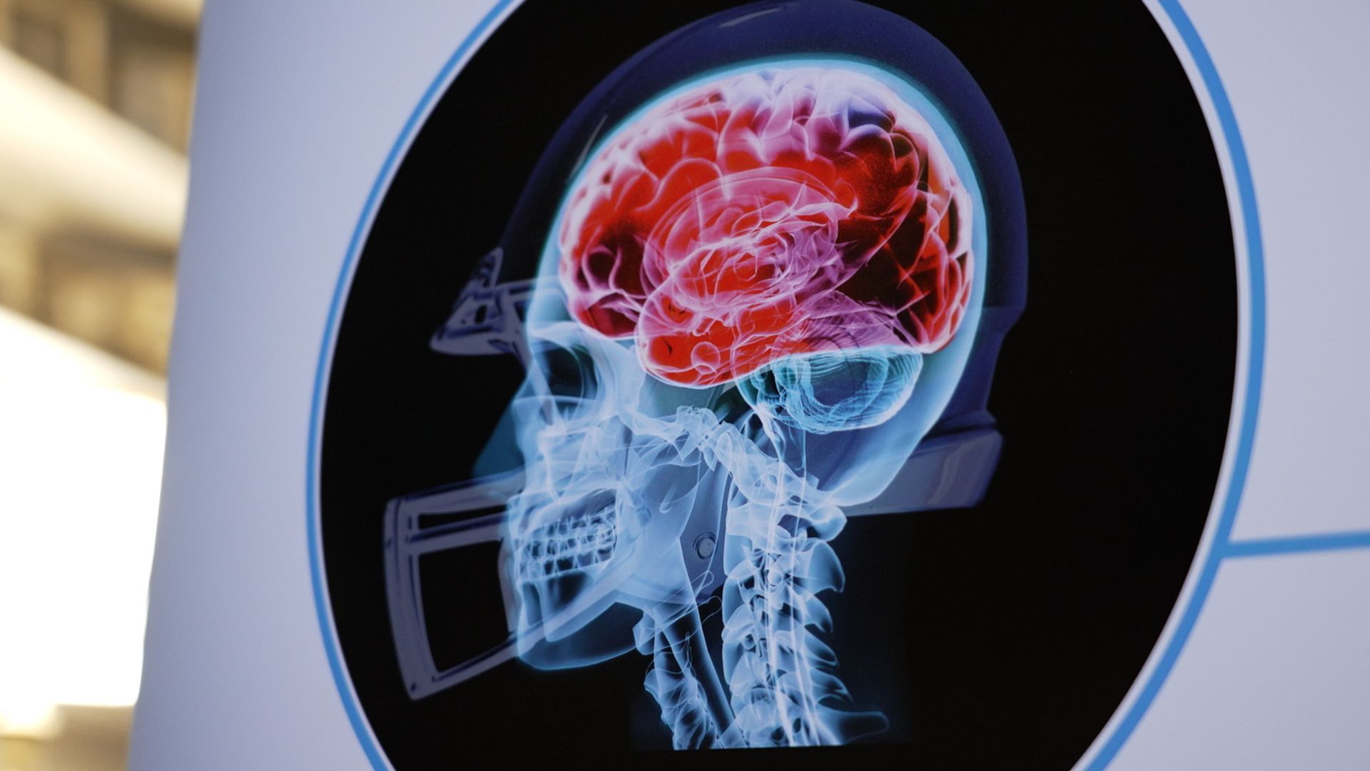 New York shooter blamed CTE, a brain disease linked to American football – but what is it?